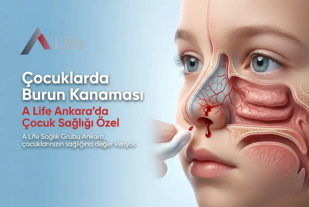 cocuklarda-burun-kanamasi-a-life-ankara_a7e9fcf6.webp
