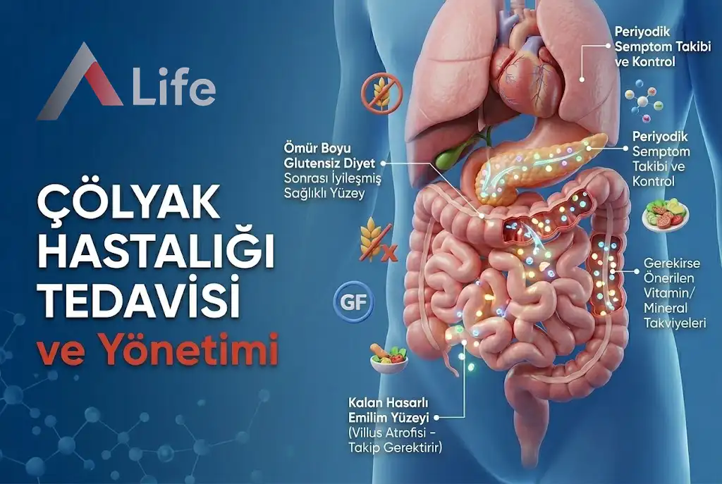 colyak-hastaligi-tedavisi-ve-yonetimi-a-life-ankara_c4ca4bce.webp