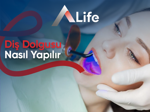 Diş Dolgusu Nasıl Yapılır?