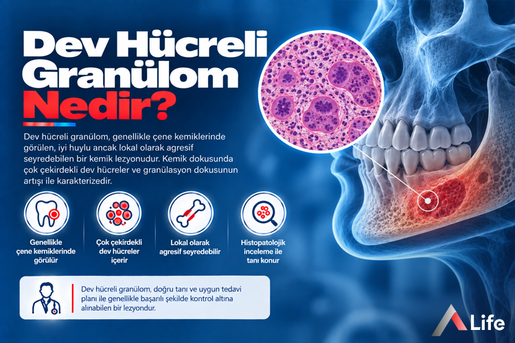 dev-hucreli-granulom-nedir_5a861d9e.webp