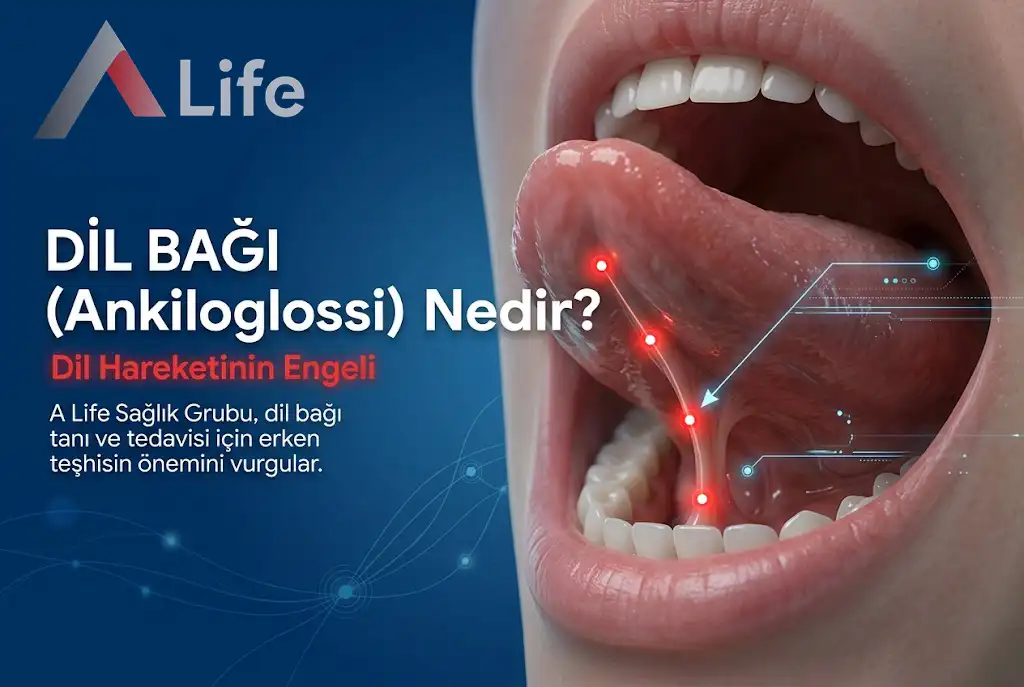 Dil Bağı (Ankiloglossi) Nedir?