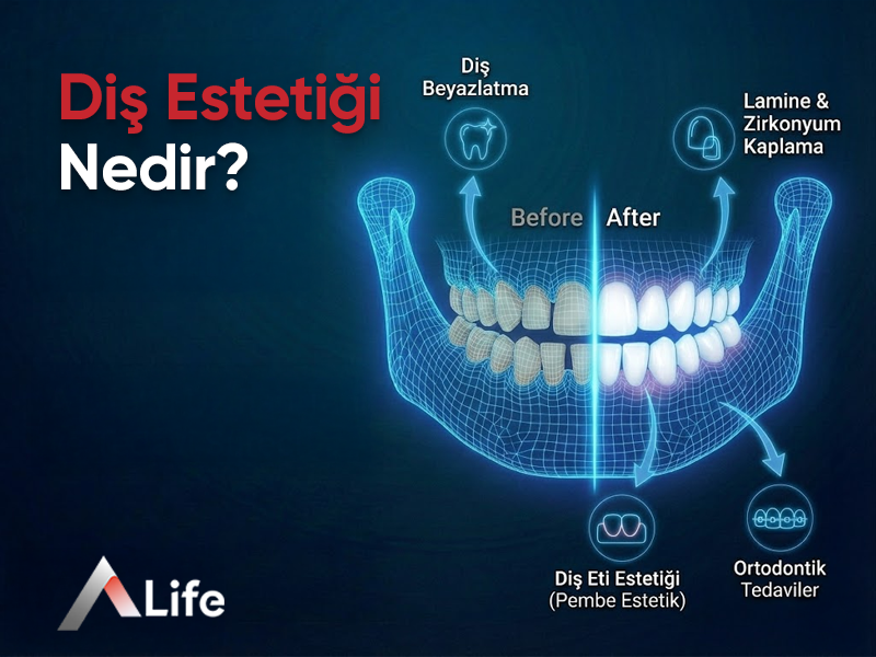 Diş Estetiği Nedir?