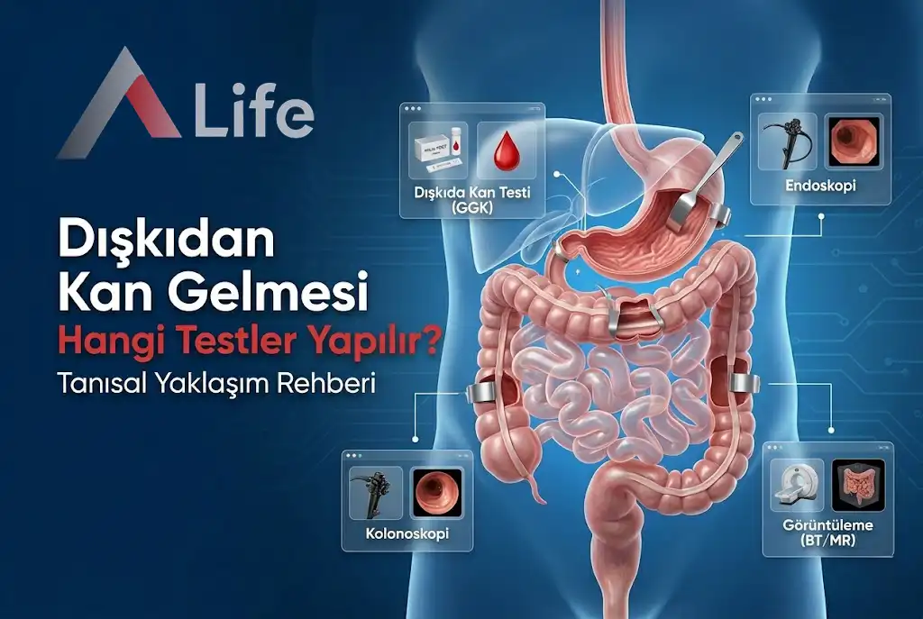 diskidan-kan-gelmesi-tanisi-hangi-testler-yapilir-a-life-ankara_64c28cc4.webp