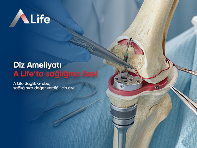 Diz Ameliyatı