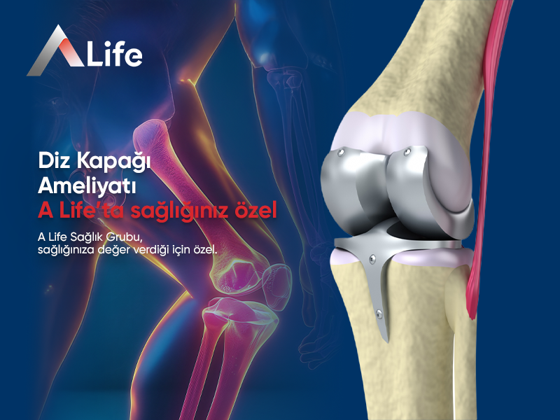 Diz Kapağı Ameliyatı