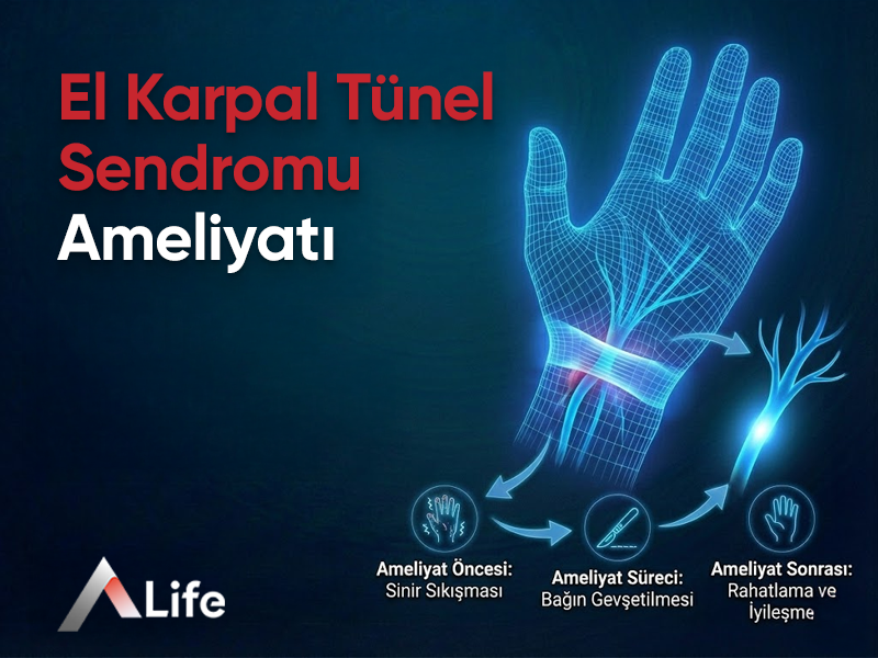 El Karpal Tünel Sendromu Ameliyatı Nedir ?