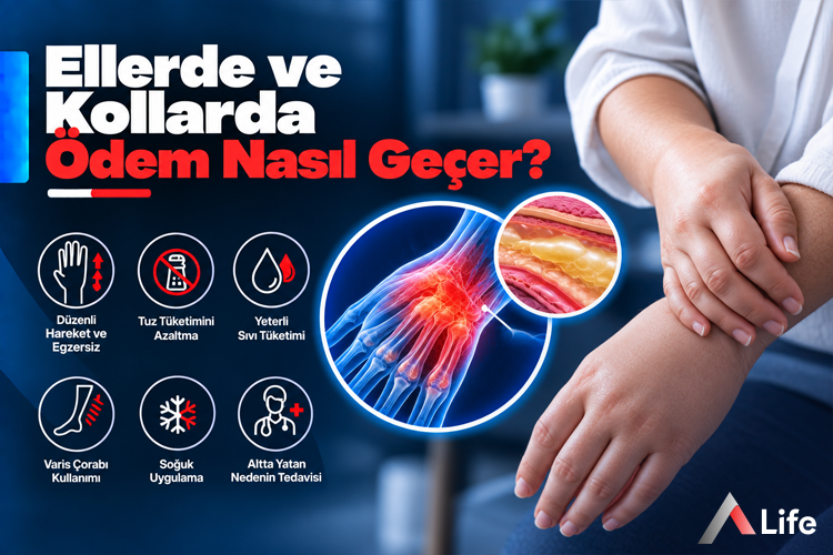 ellerde-ve-kollarda-odem-nasil-gecer_8c2c363e.webp