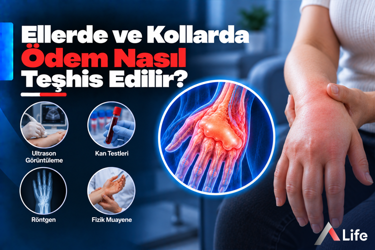 ellerde-ve-kollarda-odem-nasil-teshis-edilir_d8964b96.webp