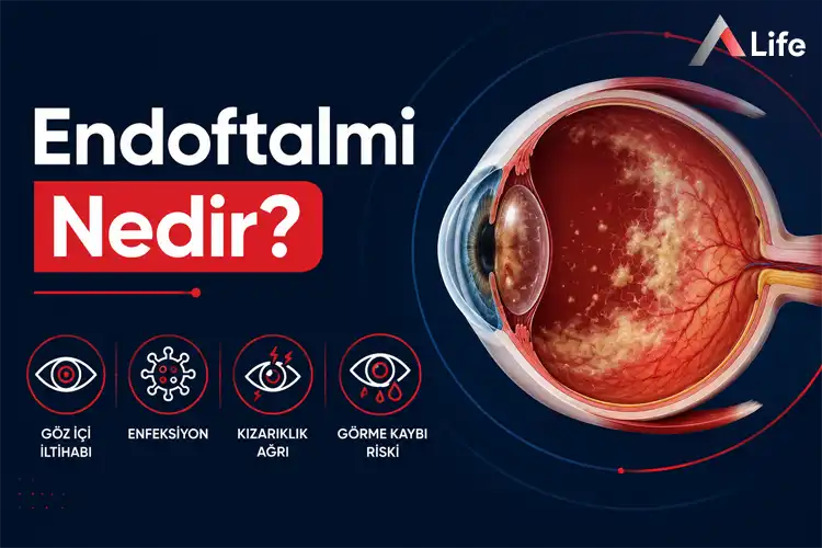 endoftalmi-nedir_f760175b.webp