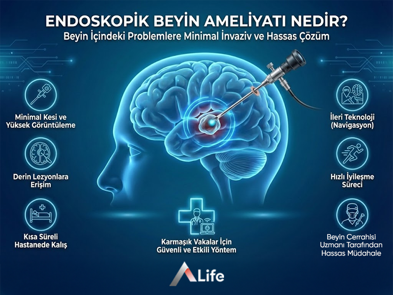 Endoskopik Beyin Ameliyatı