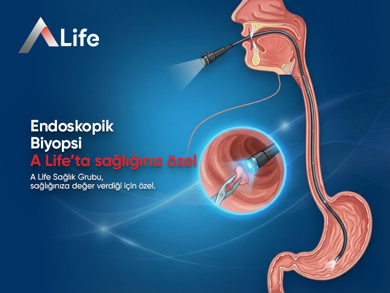 Endoskopik Biyopsi