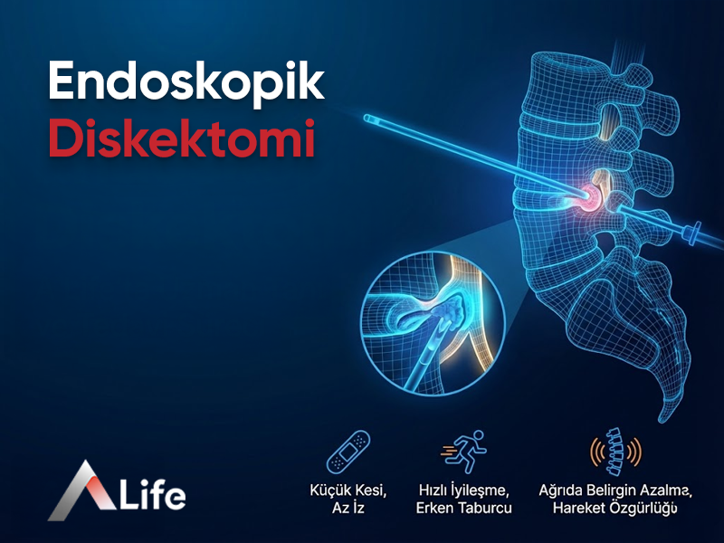 Endoskopik Diskektomi