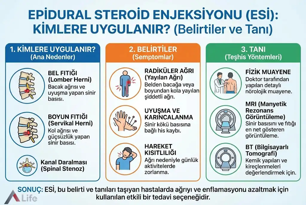 epidural-steroid-enjeksiyonu-ESI-bel-ve-boyun-fitigi-belirtileri-a-life-ankara_29c863d5.webp