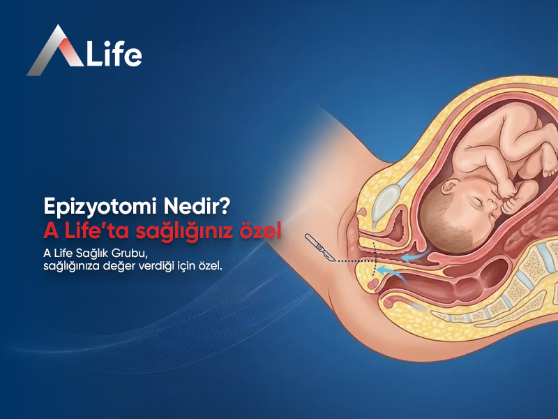 Epizyotomi Nedir?