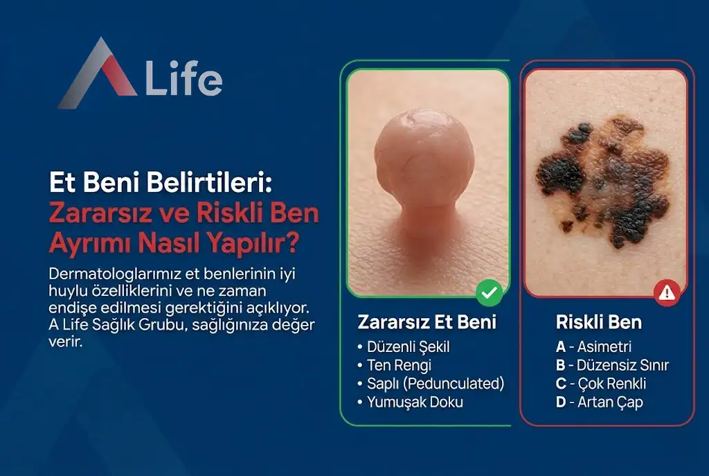 et-beni-belirtileri-zararsiz-ve-riskli-ben-ayrimi-nasil-yapilir-a-life-ankara_15e8f064.webp