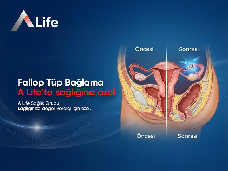 Fallop Tüp Bağlama