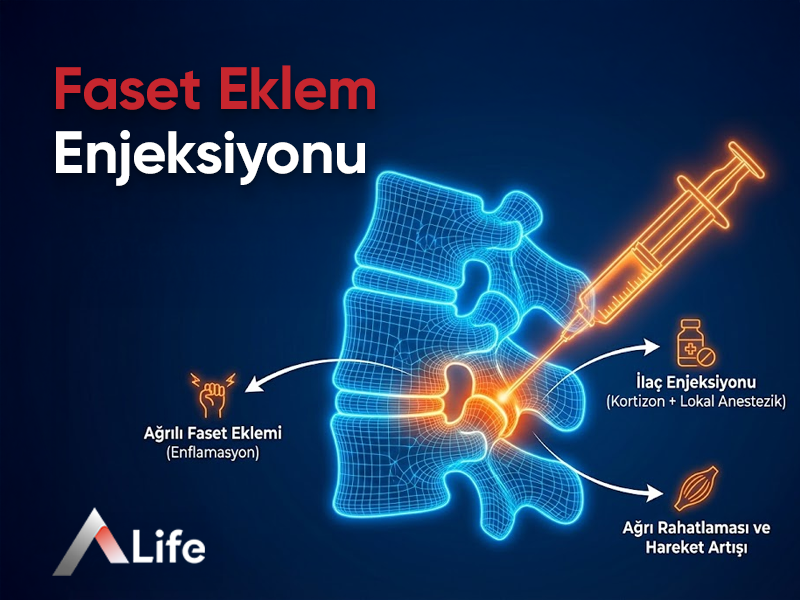 Faset Eklem Enjeksiyonu