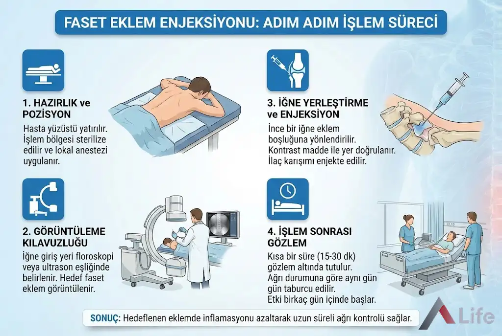 faset-eklem-enjeksiyonu-sendromu-islem-sureci-a-life-ankara_f6d166cf.webp