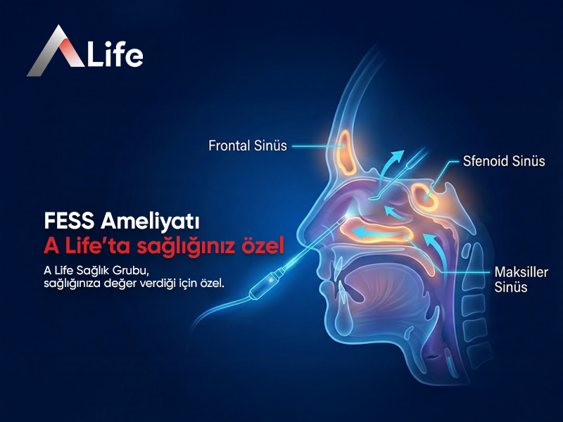 FESS Ameliyatı
