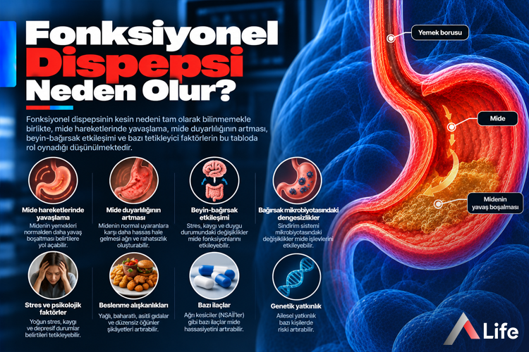fonksiyonel-dispepsi-neden-olur_fa029698.webp