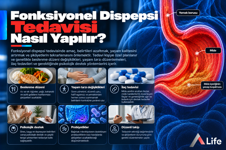 fonksiyonel-dispepsi-tedavisi-nasil-yapilir_c31e8ab8.webp