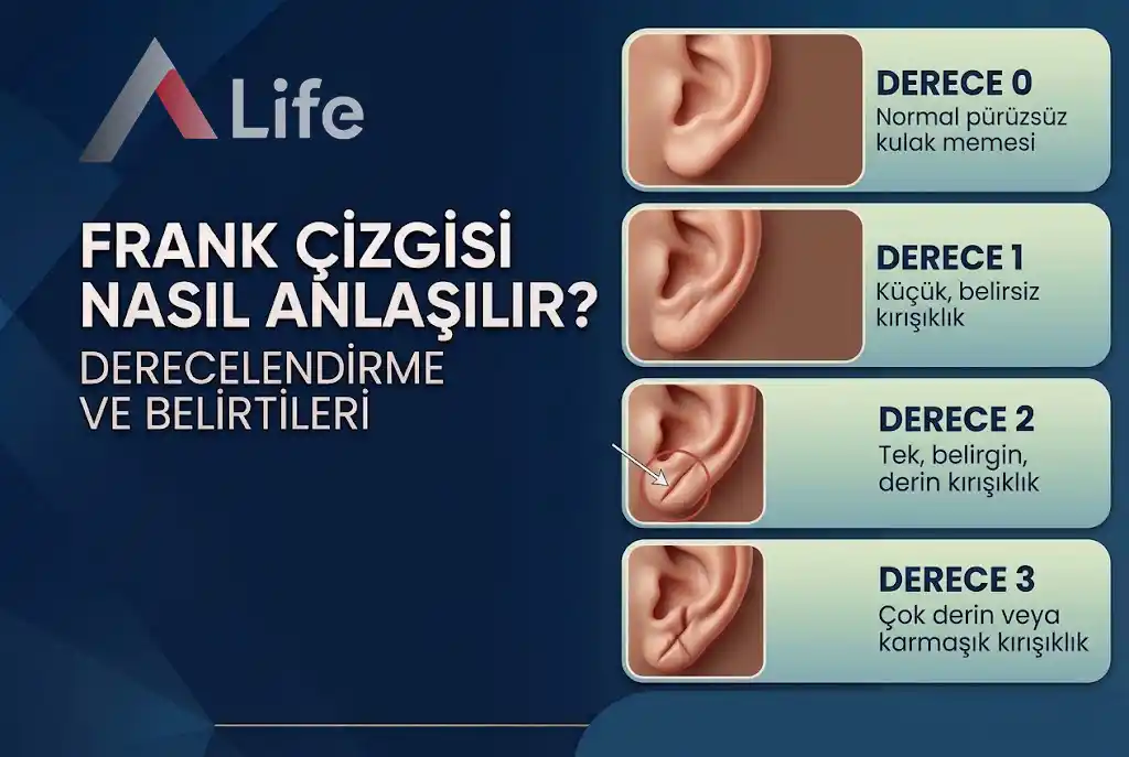 frank-cizgisi-nasil-anlasilir-a-life-ankara_048707dc.webp
