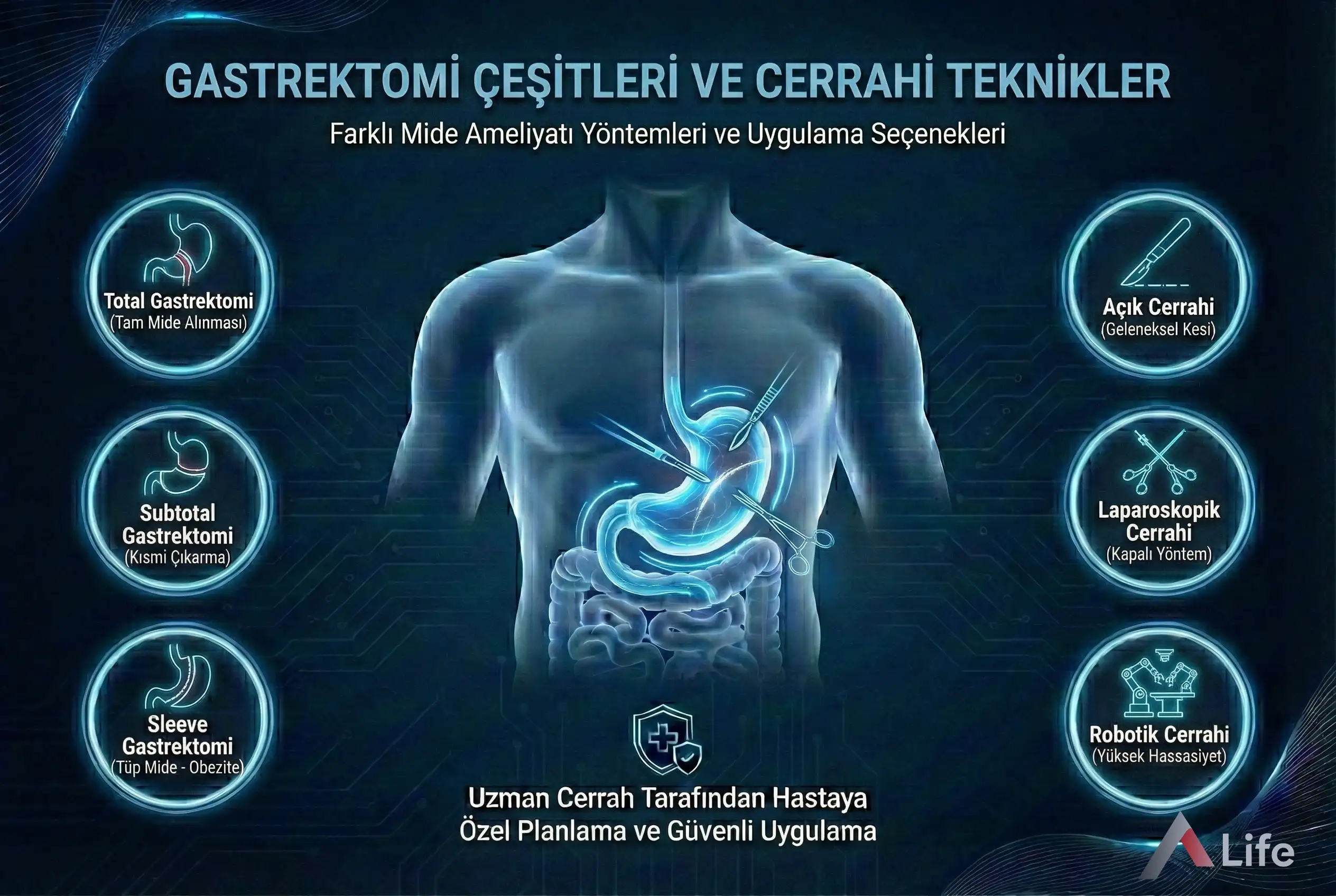 gastrektomi-nedir-cesitleri-mide-ameliyati-mide-rezeksiyonu-a-life-ankara_7928d3ba.webp
