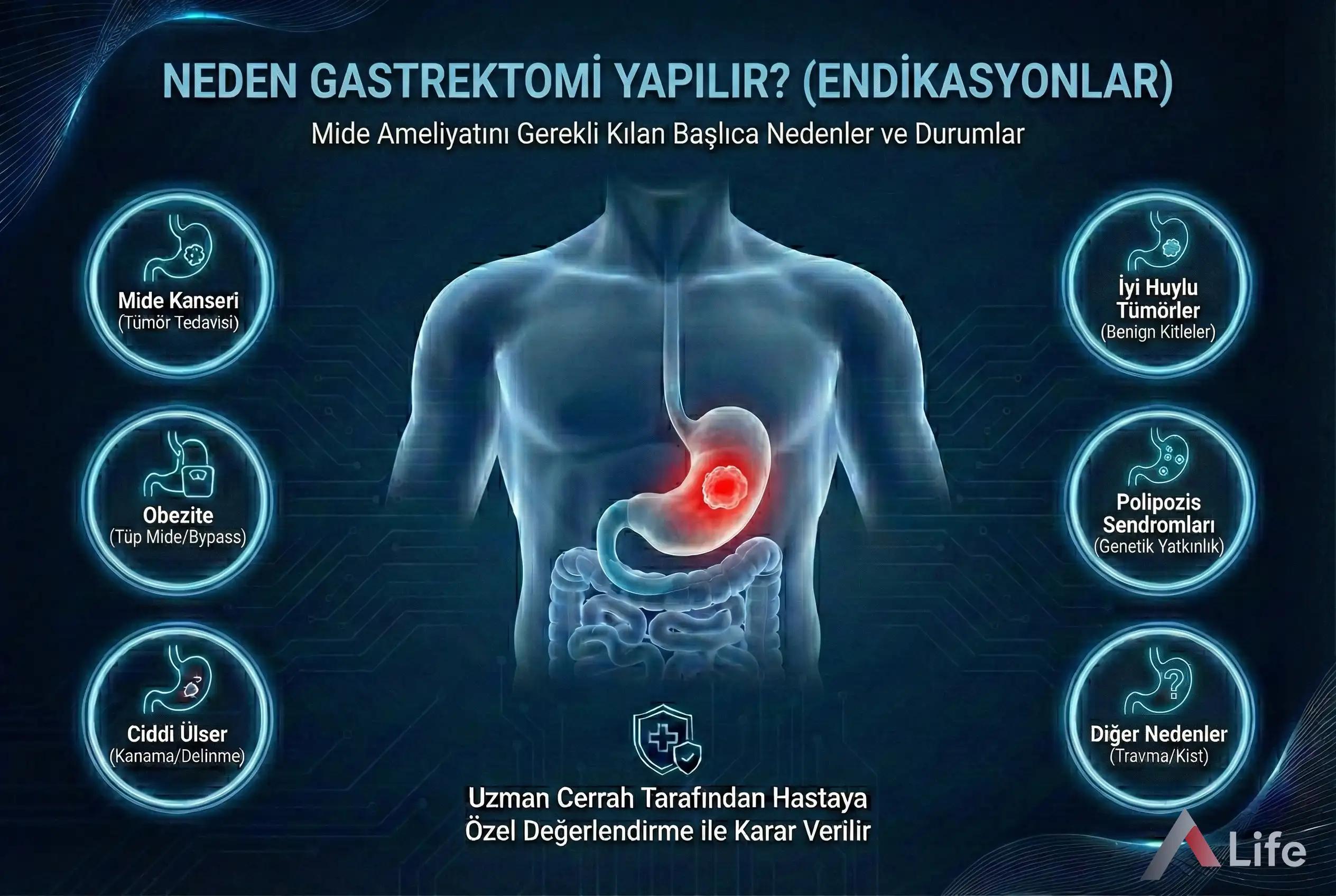 gastrektomi-nedir-neden-yapilir-mide-ameliyati-mide-rezeksiyonu-a-life-ankara_dd8a92f6.webp