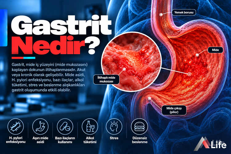 gastrit-nedir_4771bed0.webp