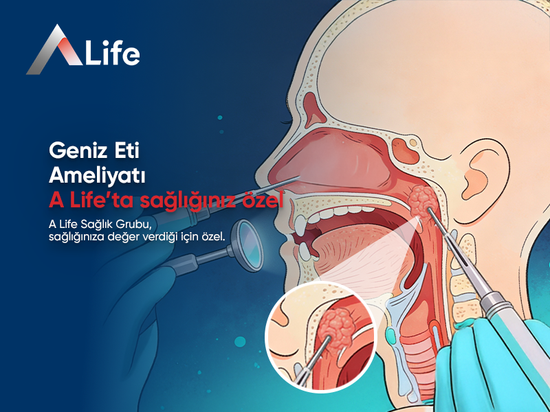 Geniz Eti Ameliyatı