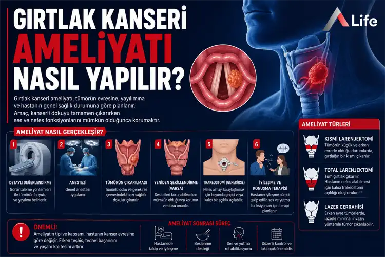 girtlak-kanseri-ameliyati-nasil-yapilir_24e9d38a.webp
