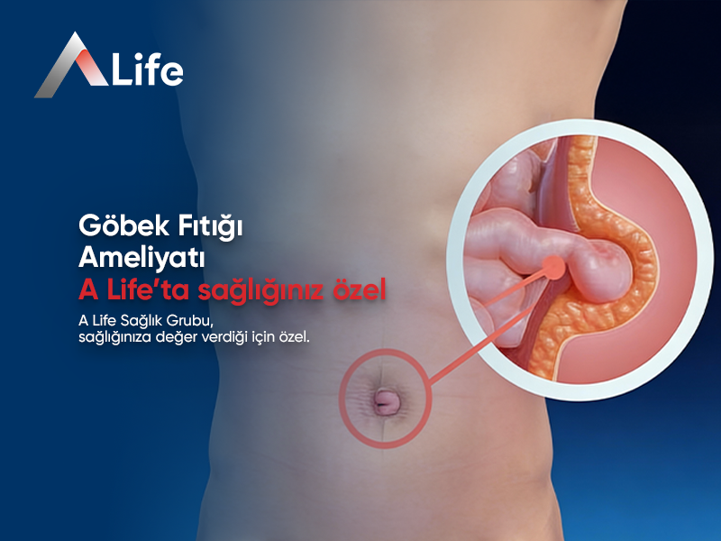 Göbek Fıtığı Ameliyatı