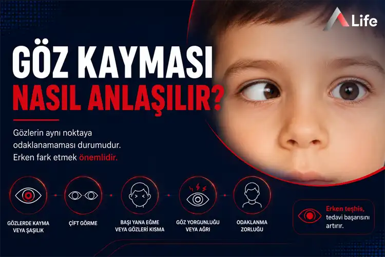 goz-kaymasi-nasil-anlasilir_8297a5a0.webp