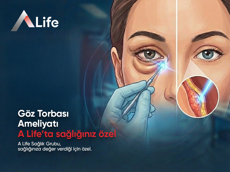 Göz Torbası Ameliyatı