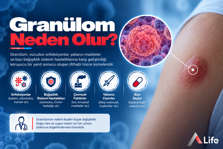 granulom-neden-olur_9b5c91b2.webp
