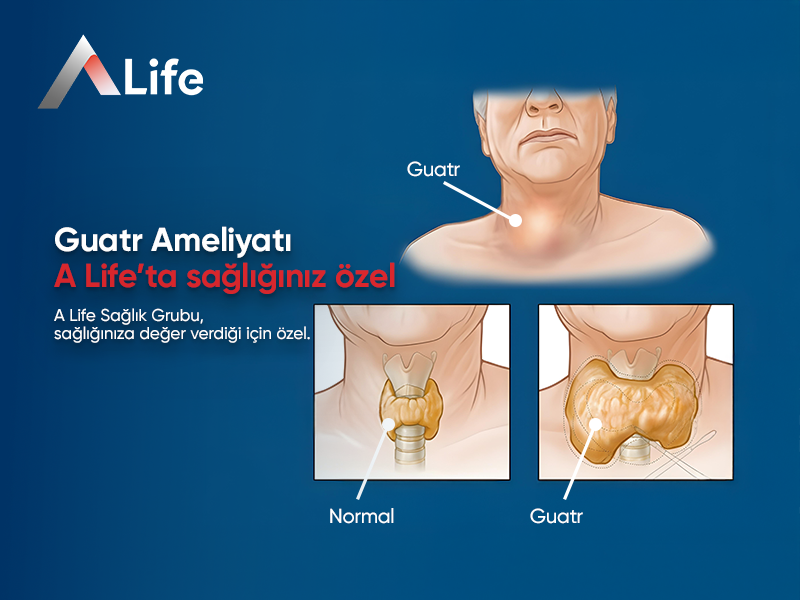 Guatr Ameliyatı