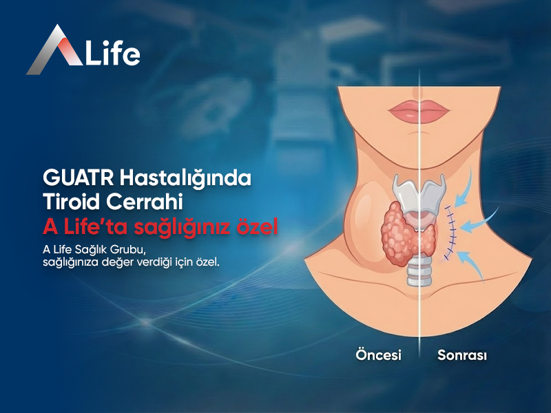 GUATR Hastalığında Tiroid Cerrahi