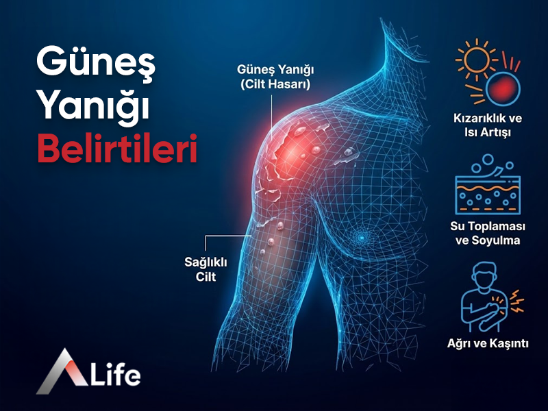 Güneş Yanığı Belirtileri