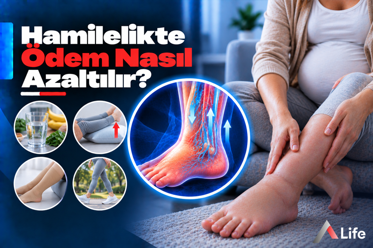 hamilelikte-odem-nasil-azaltilir_24c1a2b6.webp