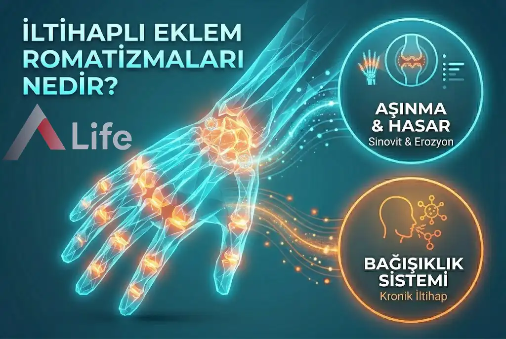 İltihaplı Eklem Romatizmaları Nedir ?