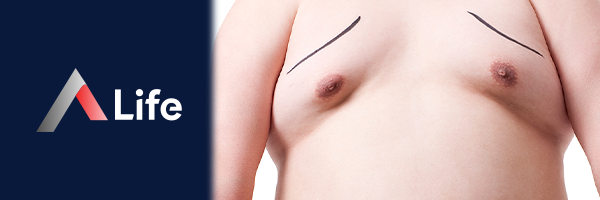 jinekomasti_liposuction____53dbb8b6.webp