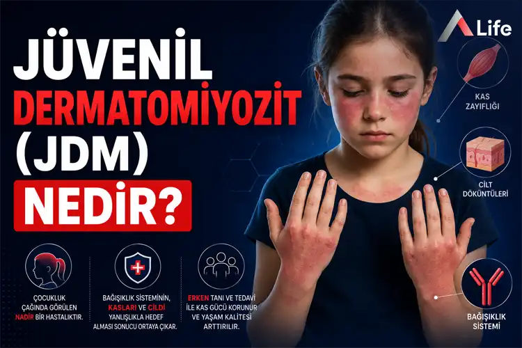 juvenil-dermatomiyozit-jdm-nedir_6e9b15a3.webp
