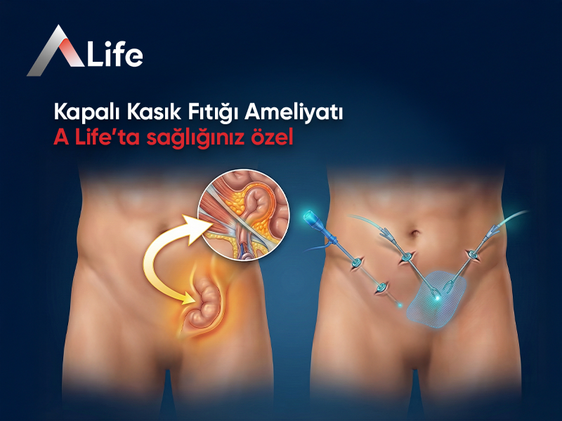 Kapalı Kasık Fıtığı Ameliyatı