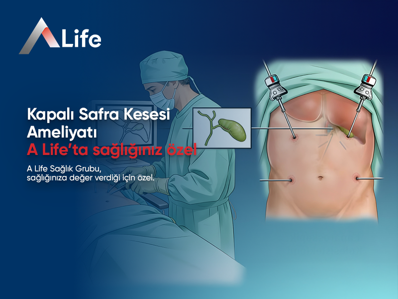 Kapalı Safra Kesesi Ameliyatı