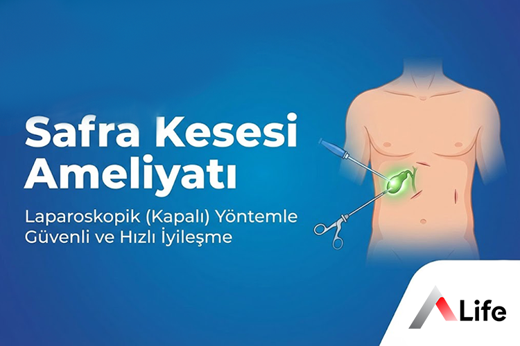kapali-safra-kesesi-ameliyati_48e00daf.webp