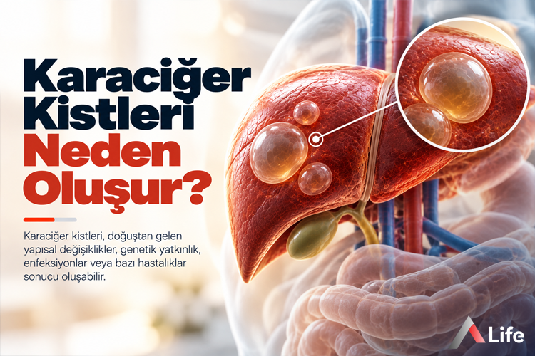 karaciger-kistleri-neden-olusur_20aea5df.webp