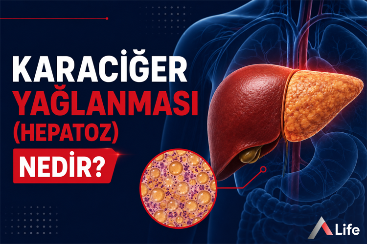 karaciger-yaglanmasi-hepatoz-nedir_56b32e4e.webp
