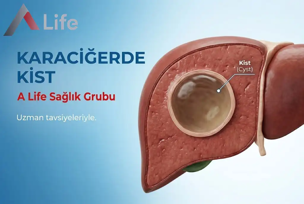Karaciğerde Kist