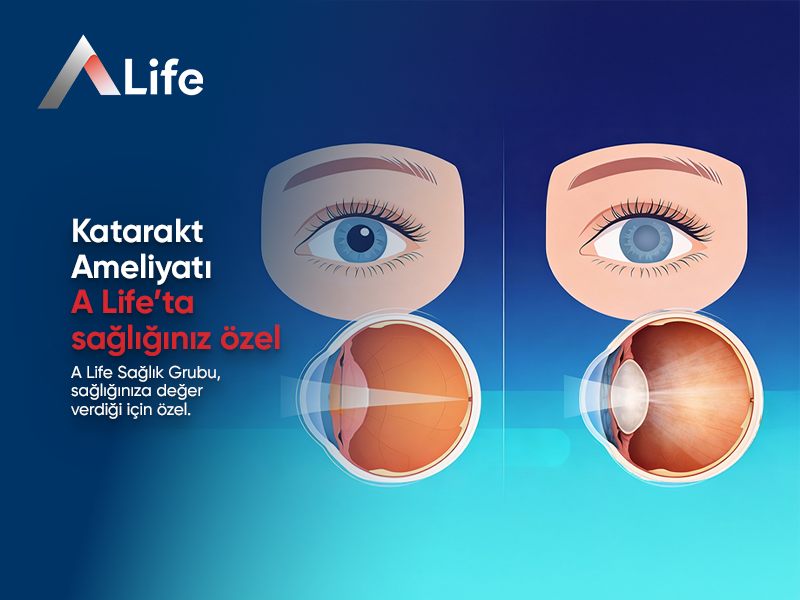 Katarakt Ameliyatı