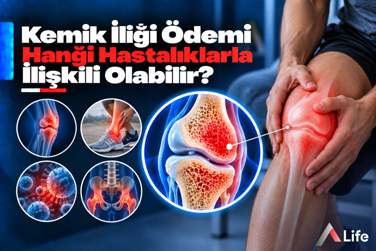 kemik-iligi-odemi-hangi-hastaliklarla-iliskili-olabilir_fb3afdcd.webp
